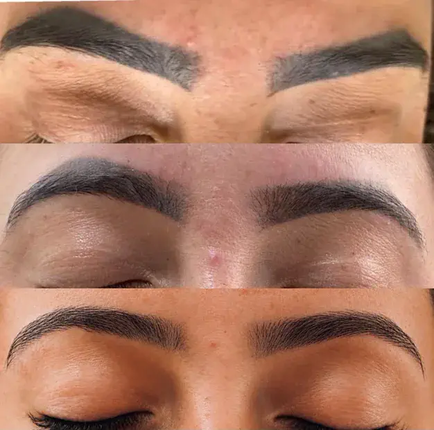 Sobrancelha com micropigmentação escura em três estágios do clareamento, até o tom natural